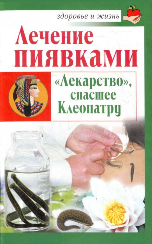Лечение пиявками. «Лекарство», спасшее Клеопатру