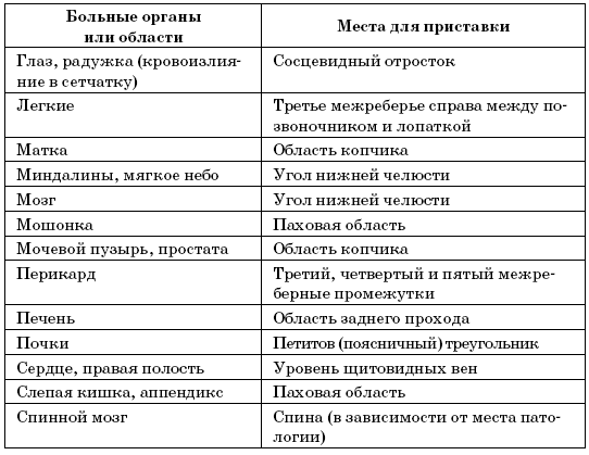 Лечение пиявками. «Лекарство», спасшее Клеопатру